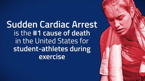 Sudden Cardiac Arrest